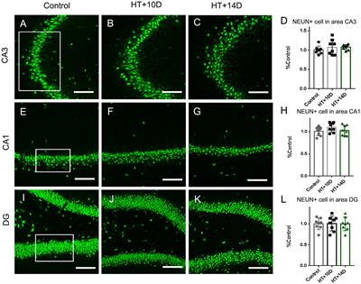 The rearrangement of actin cytoskeleton in mossy fiber synapses in a model of experimental febrile seizures